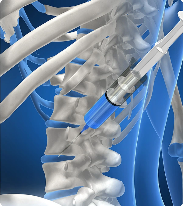 C-arm 주사치료 소개