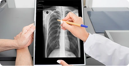 방사선 측정 (X-ray)